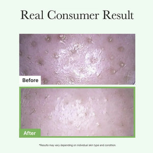 Pore Melt Mochi Cleansing Oil by ARENCIA