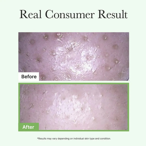 Pore Melt Mochi Cleansing Oil by ARENCIA