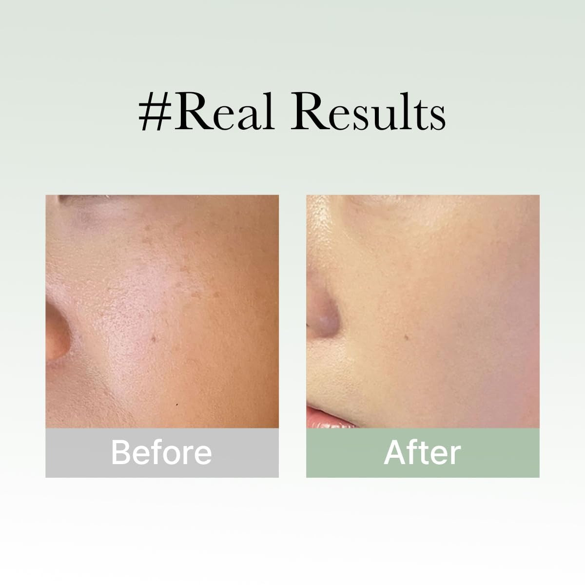 Holy Hyssop Glow Serum by Arencia