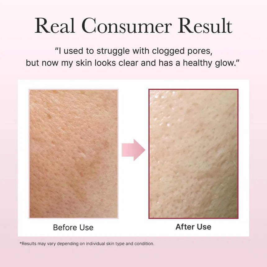 Gel de Limpeza Facial Fresh Rosehip Rice Mochi da ARENCIA