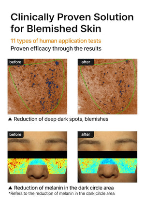 Brightning Cream for Pore+Dark Spot by CELIMAX