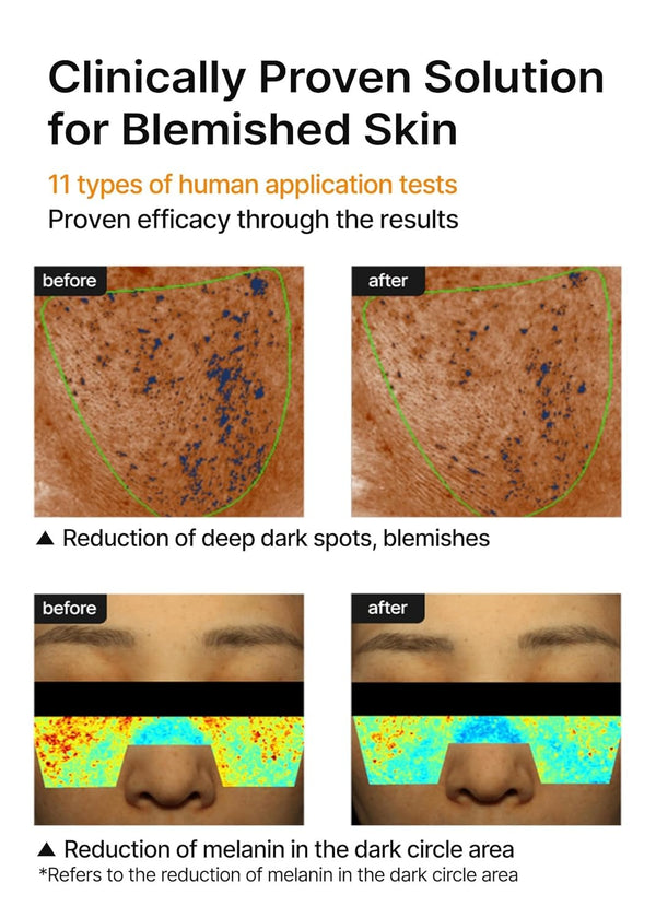 Brightning Cream for Pore+Dark Spot by CELIMAX