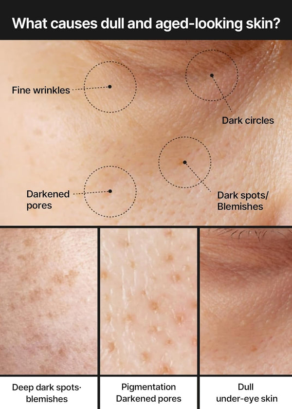 Brightning Cream for Pore+Dark Spot by CELIMAX