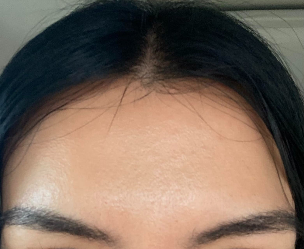 The Vita A Retinal shot Tightening Booster by CELIMAX