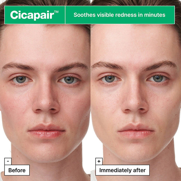 Cicapair™ Sensitive Skin Serum Face Mask for Redness by DR JART