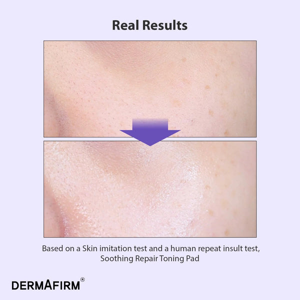 Soothing Repair Toning Pad R4 by DERMAFIRM