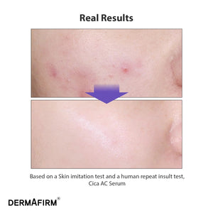 CICAA.C Serum by Dermafirm