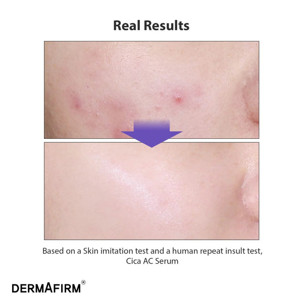 CICAA.C Serum by Dermafirm