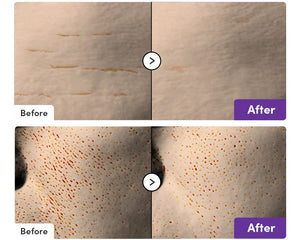 Bakuchiol Plumping Serum by EQQUALBERRY