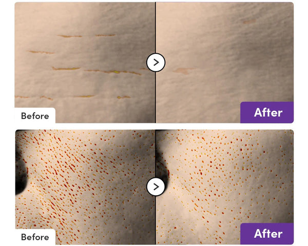 Bakuchiol Plumping Serum by EQQUALBERRY