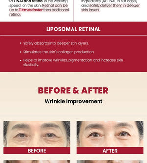 SEOUL 1988 Cream : Retinal Liposome 1% + Fermented Rice by KSECRET