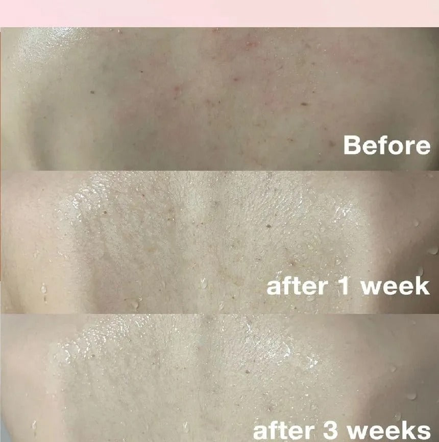 Red Body Wash by MEDICUBE