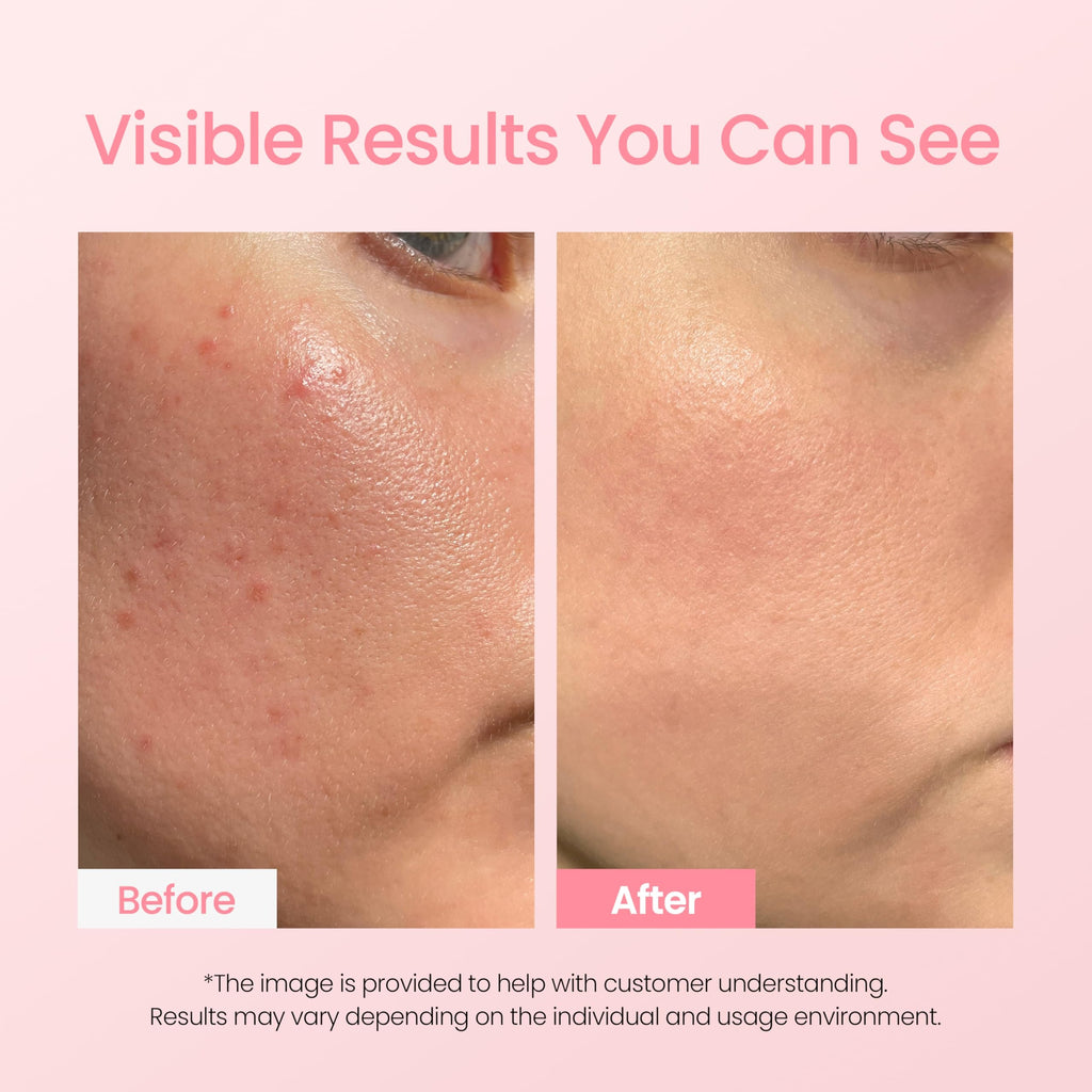 Bio-Peel Gauze Peeling Pads da NEOGENLAB