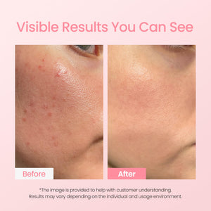 Bio-Peel Gauze Peeling Pads by NEOGENLAB