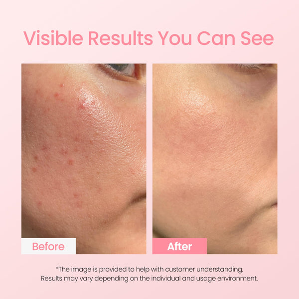 Bio-Peel Gauze Peeling Pads by NEOGENLAB