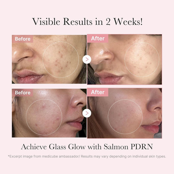 Salmon DNA PDRN Glow Trial Kit by MEDICUBE