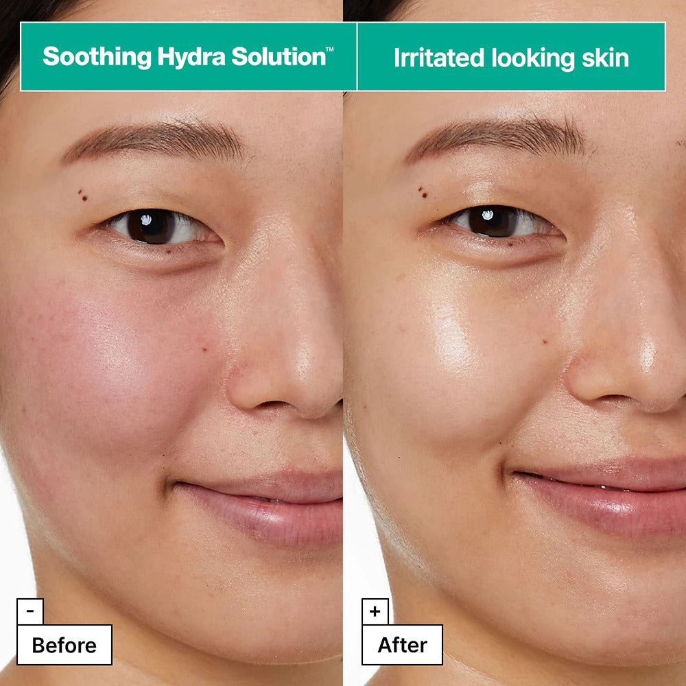 Soothing Hydra Solution™ PRO Face Mask for Irritated Skin by DR JART