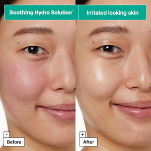Soothing Hydra Solution™ PRO Face Mask for Irritated Skin by DR JART
